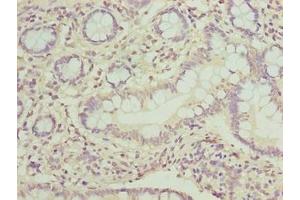 Immunohistochemistry of paraffin-embedded human small intestine tissue using ABIN7162860 at dilution of 1:100 (PPIL3 Antikörper  (AA 2-161))