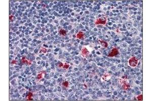 Immunohistochemistry (IHC) image for anti-Cathepsin D (CTSD) (AA 21-412) antibody (ABIN317502) (Cathepsin D Antikörper  (AA 21-412))