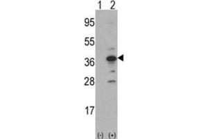 Western Blotting (WB) image for anti-DNA Segment, MCA1, Multiple CA Repeat 1 (MCA1) antibody (ABIN3002773) (MCA1 Antikörper)
