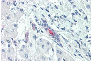 Anti-SLC5A1 / SGLT1 antibody  ABIN1049342 IHC staining of human liver. (SLC5A1 Antikörper  (Internal Region))