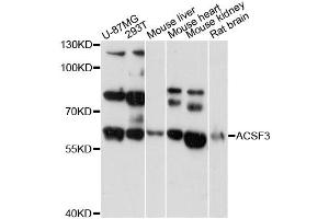 Western blot analysis of extracts of various cell lines, using ACSF3 antibody (ABIN6292804) at 1:3000 dilution. (ACSF3 Antikörper)