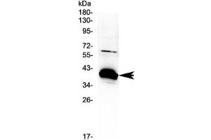 Western blot testing of rat kidney tissue with BAG1 antibody at 0.