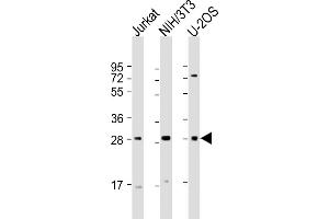 All lanes : Anti-SIX1 Antibody (Center) at 1:2000 dilution Lane 1: Jurkat whole cell lysate Lane 2: NIH/3T3 whole cell lysate Lane 3: U-2OS whole cell lysate Lysates/proteins at 20 μg per lane. (SIX Homeobox 1 Antikörper  (AA 69-102))