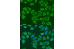 Immunofluorescence analysis of U2OS cells using  antibody (ABIN6131173, ABIN6136581, ABIN6136582 and ABIN6223850) at dilution of 1:100. (ADH7 Antikörper  (AA 1-386))