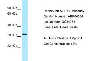 Western Blotting (WB) image for anti-Surfactant Associated Protein A2 (SFTPA2) (N-Term) antibody (ABIN2789704)