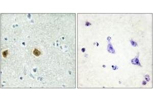 Immunohistochemistry analysis of paraffin-embedded human brain tissue, using NDUC2 Antibody. (NDUFC2 Antikörper  (AA 51-100))