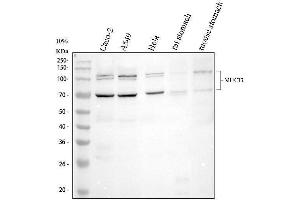 Western blot analysis of MUC13 using anti-MUC13 antibody (ABIN6719597).