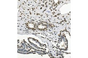 IHC analysis of HP1 alpha/CBX5 using anti-HP1 alpha/CBX5 antibody (ABIN7599058). (CBX5 Antikörper  (AA 1-191))