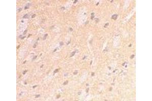 Immunohistochemical staining of rat brain using AP30071PU-N APP antibody at 2 μg/ml. (APP Antikörper  (C-Term))