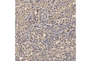 IHC analysis of SNRPA1 using anti-SNRPA1 antibody (ABIN7599131). (SNRPA1 Antikörper  (AA 1-233))