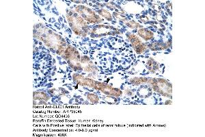 Human kidney (CLIC1 Antikörper  (N-Term))