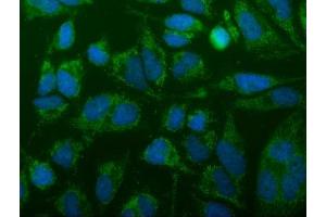 IF analysis of FIS1 using anti-FIS1 antibody (ABIN7598965). (Fission 1 Antikörper  (AA 1-121))