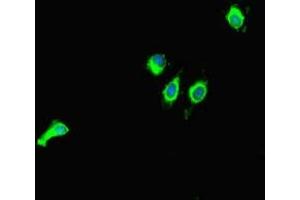 Immunofluorescent analysis of Hela cells using ABIN7160851 at dilution of 1:100 and Alexa Fluor 488-congugated AffiniPure Goat Anti-Rabbit IgG(H+L) (SIRT1 Antikörper  (AA 2-747))