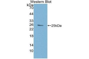 Western Blotting (WB) image for anti-B-Cell CLL/lymphoma 9 (BCL9) (AA 1119-1328) antibody (ABIN3201061) (BCL9 Antikörper  (AA 1119-1328))