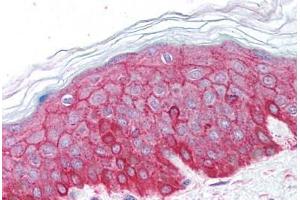 Human Skin (formalin-fixed, paraffin-embedded) stained with ACTB antibody ABIN213653 at 5 ug/ml followed by biotinylated goat anti-rabbit IgG secondary antibody ABIN481713, alkaline phosphatase-streptavidin and chromogen. (beta Actin Antikörper  (C-Term))