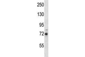 RIPK1 antibody western blot analysis in MDA-MB231 lysate. (RIPK1 Antikörper  (AA 152-180))