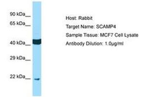 Image no. 1 for anti-Secretory Carrier Membrane Protein 4 (SCAMP4) (AA 41-90) antibody (ABIN6750134)