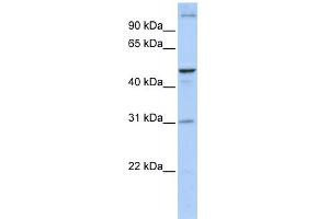 WB Suggested Anti-ACBD5 Antibody Titration:  0. (ACBD5 Antikörper  (N-Term))