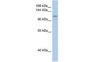 PRPF6 antibody used at 2. (PRP6/ANT-1 Antikörper)