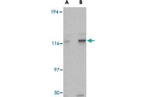 Western blot analysis of KIF5A in K-562 cell lysate with KIF5A polyclonal antibody  at (A) 0. (KIF5A Antikörper  (AA 330-380))