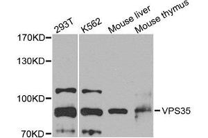 Western blot analysis of extracts of various cell lines, using VPS35 antibody. (VPS35 Antikörper  (AA 1-250))
