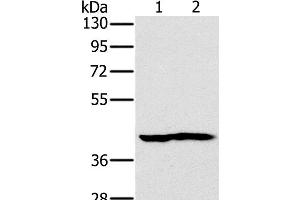 Western Blot analysis of Mouse heart and kidney tissue using NDUFA10 Polyclonal Antibody at dilution of 1:450 (NDUFA10 Antikörper)