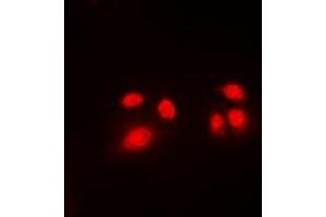 Immunofluorescent analysis of CBFB staining in Jurkat cells. (CBFB Antikörper  (N-Term))