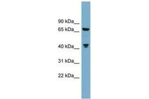 Image no. 1 for anti-Glutaminase (GLS) (C-Term) antibody (ABIN6743797) (Glutaminase Antikörper  (C-Term))