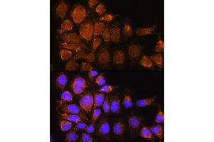 Immunofluorescence analysis of HeLa cells using SYNE3 Rabbit pAb (ABIN6131129, ABIN6148766, ABIN6148767 and ABIN6217163) at dilution of 1:100. (Nesprin3 Antikörper  (AA 740-920))