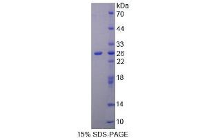 SDS-PAGE (SDS) image for Keratin 1 (KRT1) (AA 350-488) protein (His tag) (ABIN1099220)
