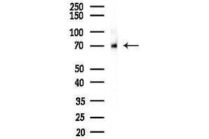 Western blot analysis of lysates from Mouse brain, using Zyxin Antibody at 1/1000 dilution.