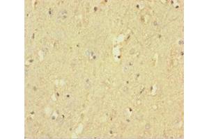 Immunohistochemistry of paraffin-embedded human brain tissue using ABIN7167522 at dilution of 1:100 (PTPRZ1 Antikörper  (AA 36-300))