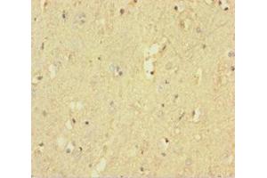 Immunohistochemistry of paraffin-embedded human brain tissue using ABIN7167522 at dilution of 1:100