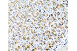 Immunohistochemistry of paraffin-embedded Mouse stomach using FECH Polyclonal Antibody at dilution of 1:100 (40x lens). (FECH Antikörper)