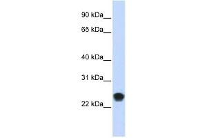 FKBP11 antibody used at 1 ug/ml to detect target protein. (FKBP11 Antikörper  (N-Term))
