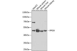 Western blot analysis of extracts of various cell lines, using PPOX Antibody (ABIN6129092, ABIN6146051, ABIN6146052 and ABIN6222026) at 1:1000 dilution. (PPOX Antikörper  (AA 1-280))