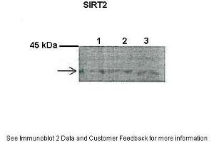 Lanes:   1. (SIRT2 Antikörper  (C-Term))
