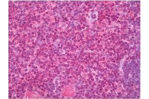 Thymus stained with Cellubrevin antibody in Immunohistochemistry on Paraffin Sections. (VAMP3 Antikörper  (N-Term))