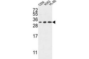 Western Blotting (WB) image for anti-Tetraspanin 2 (TSPAN2) antibody (ABIN3004129) (Tetraspanin 2 Antikörper)