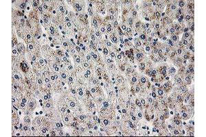 Immunohistochemical staining of paraffin-embedded Human liver tissue using anti-PGAM2 mouse monoclonal antibody. (PGAM2 Antikörper)