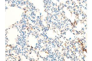 ABIN6255402 and ABIN6267070 at 1/100 staining rat lung tissue sections by IHC-P.