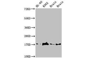 Western Blot Positive WB detected in: HL60 whole cell lysate, K562 whole cell lyaste, Mouse brain tissue, Rat brain tissue All lanes: UBE2V2 antibody at 1. (UBE2V2 Antikörper  (AA 2-145))
