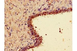 Immunohistochemistry (IHC) image for anti-Wingless-Type MMTV Integration Site Family, Member 7A (WNT7A) (AA 126-302) antibody (ABIN7166309)