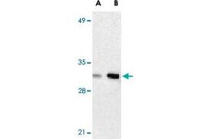 Western blot analysis of ANP32A expression in human Raji cell lysate with ANP32A polyclonal antibody  at 2 ug/mL (lane A) and 4 ug/mL (lane B), respectively. (PHAP1 Antikörper  (C-Term))
