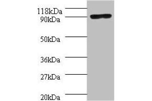 Western blot All lanes: Aquaticus DNA polymerase I, thermostable antibody at 2 μg/mL + 293T whole cell lysate Secondary Goat polyclonal to rabbit IgG at 1/10000 dilution Predicted band size: 94 kDa Observed band size: 94 kDa (POLA1 Antikörper  (AA 310-832))