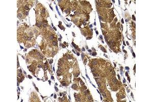 Immunohistochemistry of paraffin-embedded Human stomach using STAMBP Polyclonal Antibody at dilution of 1:100 (40x lens). (STAMBP Antikörper)