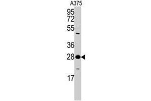 Western blot analysis of YWHAZ polyclonal antibody  in A-375 cell lysate (35 ug/lane). (14-3-3 zeta Antikörper  (Thr232))