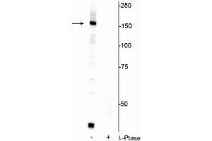Western blot of HeLa cell lysate showing specific immunolabeling of the ~150 kDa FANCI protein phosphorylated at Ser556 in the first lane (-). (FANCI Antikörper  (pSer556))