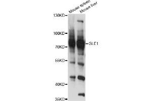 Western blot analysis of extracts of various cell lines, using GLE1 antibody (ABIN6293108) at 1:3000 dilution. (GLE1 Antikörper)