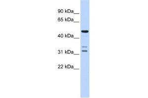 HTRA4 antibody used at 1 ug/ml to detect target protein. (HTRA4 Antikörper  (Middle Region))